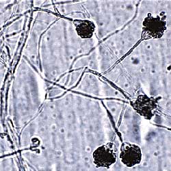 Microscopic photo of stachybotrys